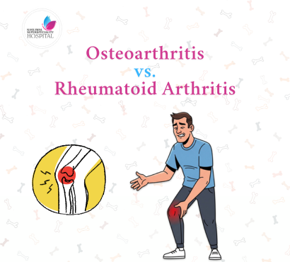 Osteoarthritis vs. Rheumatoid Arthritis: What’s the Difference?