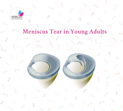 Meniscus Tear in Young Adults: Sports Injury Basics